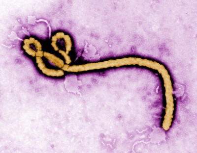 In a report from Massachusetts General Hospital, a survey found that many physicians overestimate their ability to assess the risk of Ebola. PHOTO COURTESY CDC GLOBAL