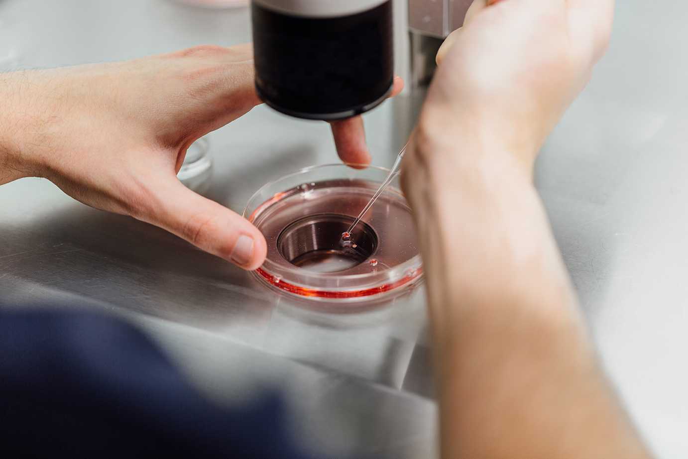 A petri dish similar to one used in-vitro fertilization (IVF). Artificial insemination often requires multiple attempts as well as sufficient financial and psychological preparation. COURTESY OF COM SALUD AGENCIA DE COMUNICACIÓN VIA FLICKR
