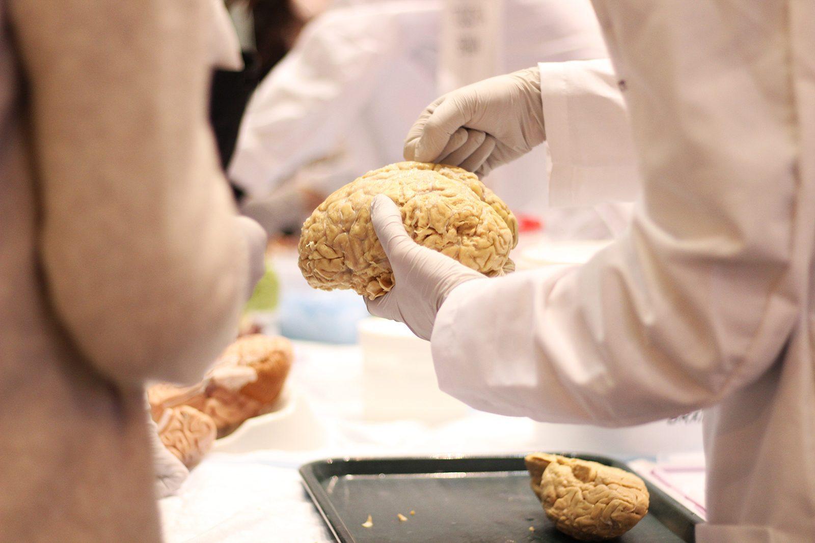 Boston University's Chronic Traumatic Encephalopathy Center releases a major study on July 25 detailing the possible link between playing football and suffering from CTE, a neurodegenerative brain disease. PHOTO BY FRANCHESCA VIAUD/DFP FILE PHOTO
