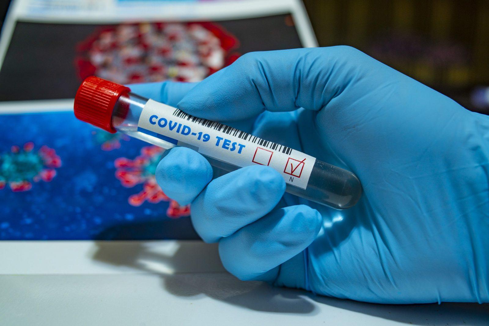 The Boston Public Health Commission is encouraging residents and businesses to get tested for COVID-19 as a part of its new “Get the Test Boston” campaign, which was announced on Friday. COURTESY OF PIXABAY

