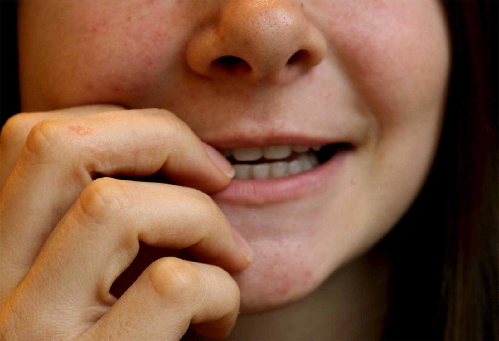Boston University Student Government sent out a survey Oct.16 to gain feedback on BU’s mental health resources. PHOTO ILLUSTRATION BY ANNALYN KUMAR/DAILY FREE PRESS CONTRIBUTOR
